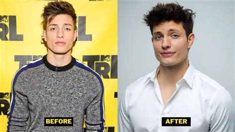 matt rife body|Matt Rife Denies Plastic Surgery Rumors, Blames Changed。